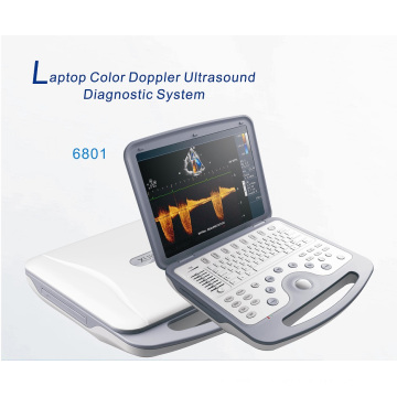 High Quality Full Digital Ultrasound Scanner (XT-FL038)